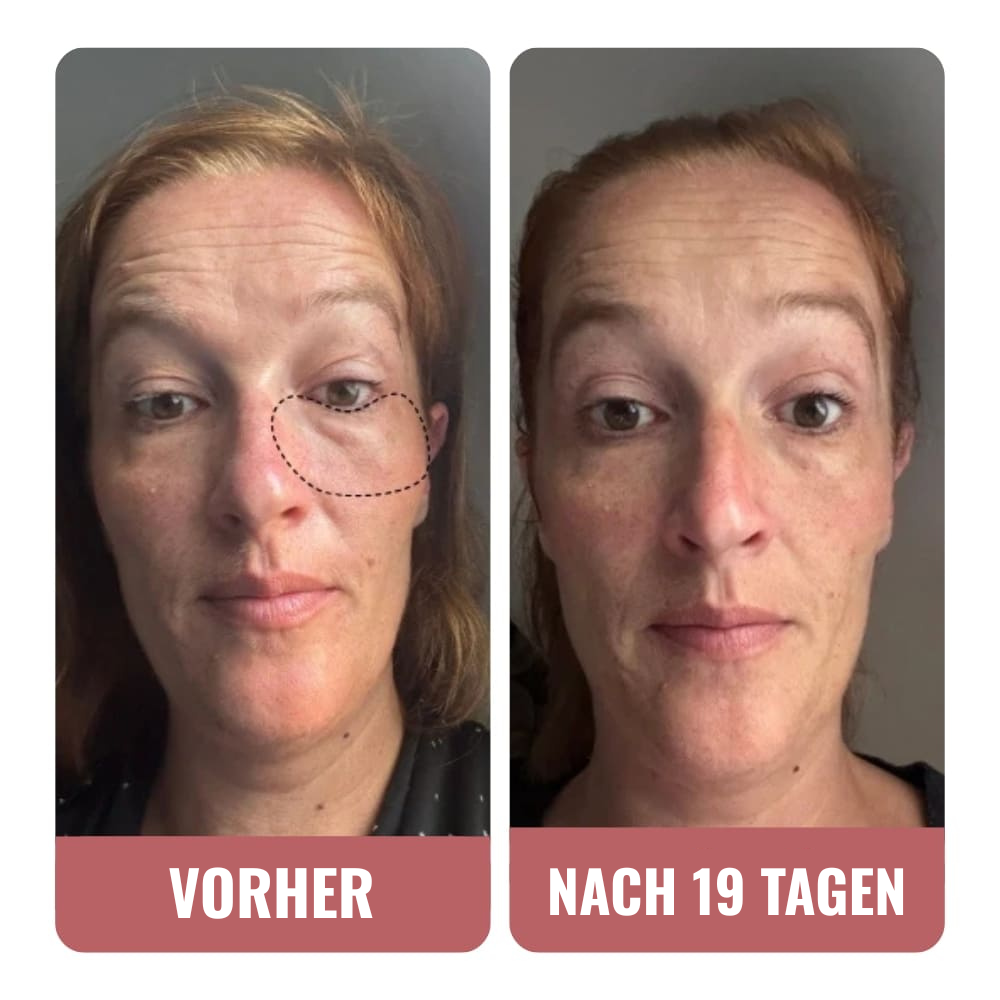 Ein sofortiger Effekt auf die Textur meiner Haut.