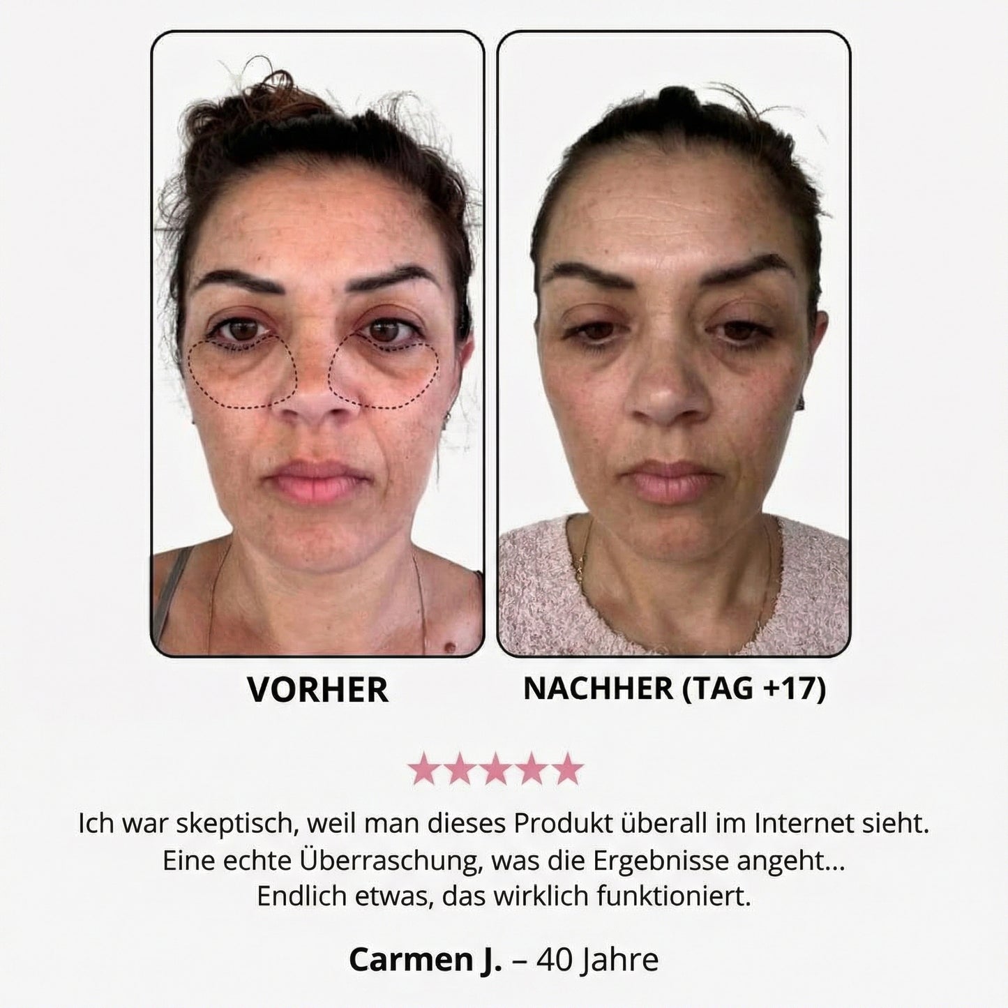 Creme mit rotem Licht für die Augenpartie